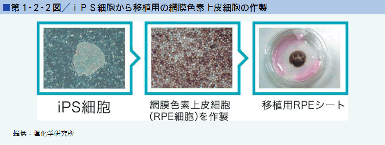 第1‐2‐2図／iPS細胞から移植用の網膜色素上皮細胞の作製