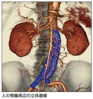 人の腎臓周辺の立体画像