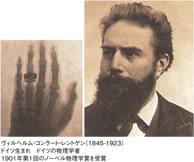 手と指輪のエックス線写真、ヴィルヘルム・コンラート・レントゲン