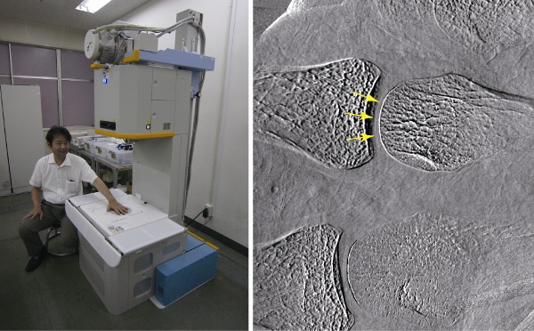 図2：リウマチの早期診断を目的として開発した装置（左）で、これまで見えなかった軟骨の観察が可能に（右）。黄色矢印で示した部分が軟骨。