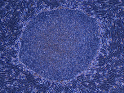 線維芽細胞から樹立したヒトiPS細胞のコロニー（集合体）