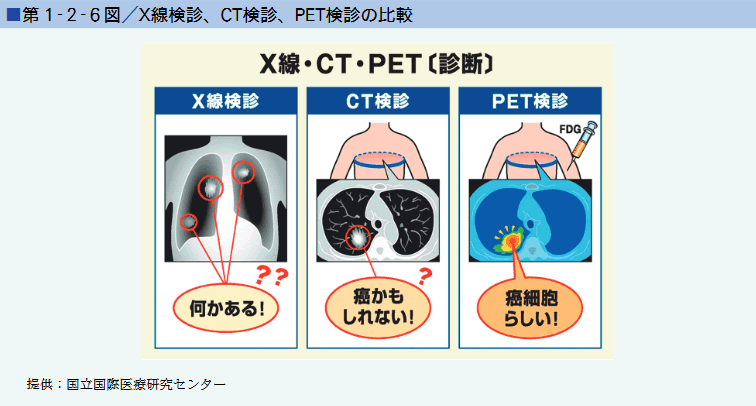第1‐2‐6図／X線検診、CT検診、PET検診の比較