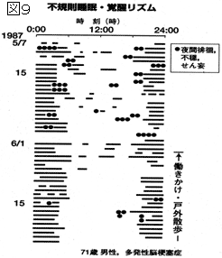 図9　不規則睡眠・覚醒リズム