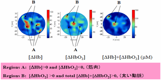 図13　前腕の運動負荷による血液状態変化に関する拡散光トモグラフィー画像