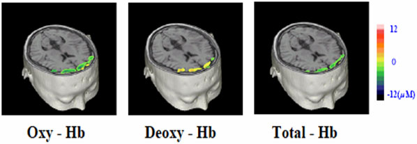 図14　反射型拡散光トモグラフィーによるビデオゲーム時の前頭前野の脳活動に伴う血液状態の変化