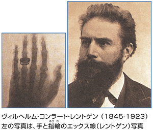 手と指輪のエックス線（レントゲン）写真、ヴィルヘルム・コンラート・レントゲン（1845－1923）