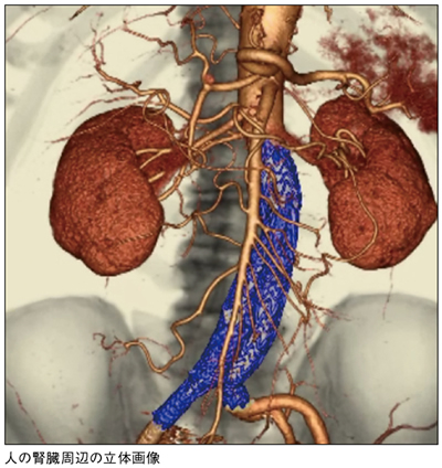 人の腎臓周辺の立体画像